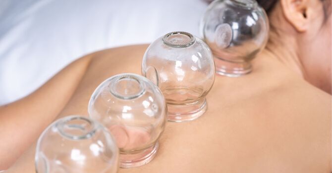 Electroacupuncture 